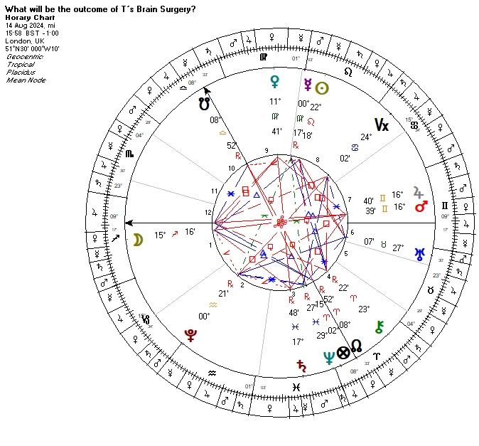 ¿Cuál será el resultado de la cirugía de tumor cerebral mañana?